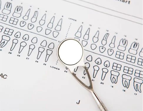 Aligner progress and refinements