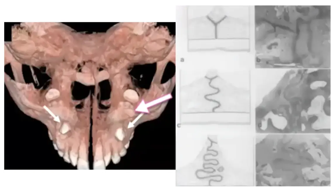 Imaging and diagram reference of the midpalatal suture