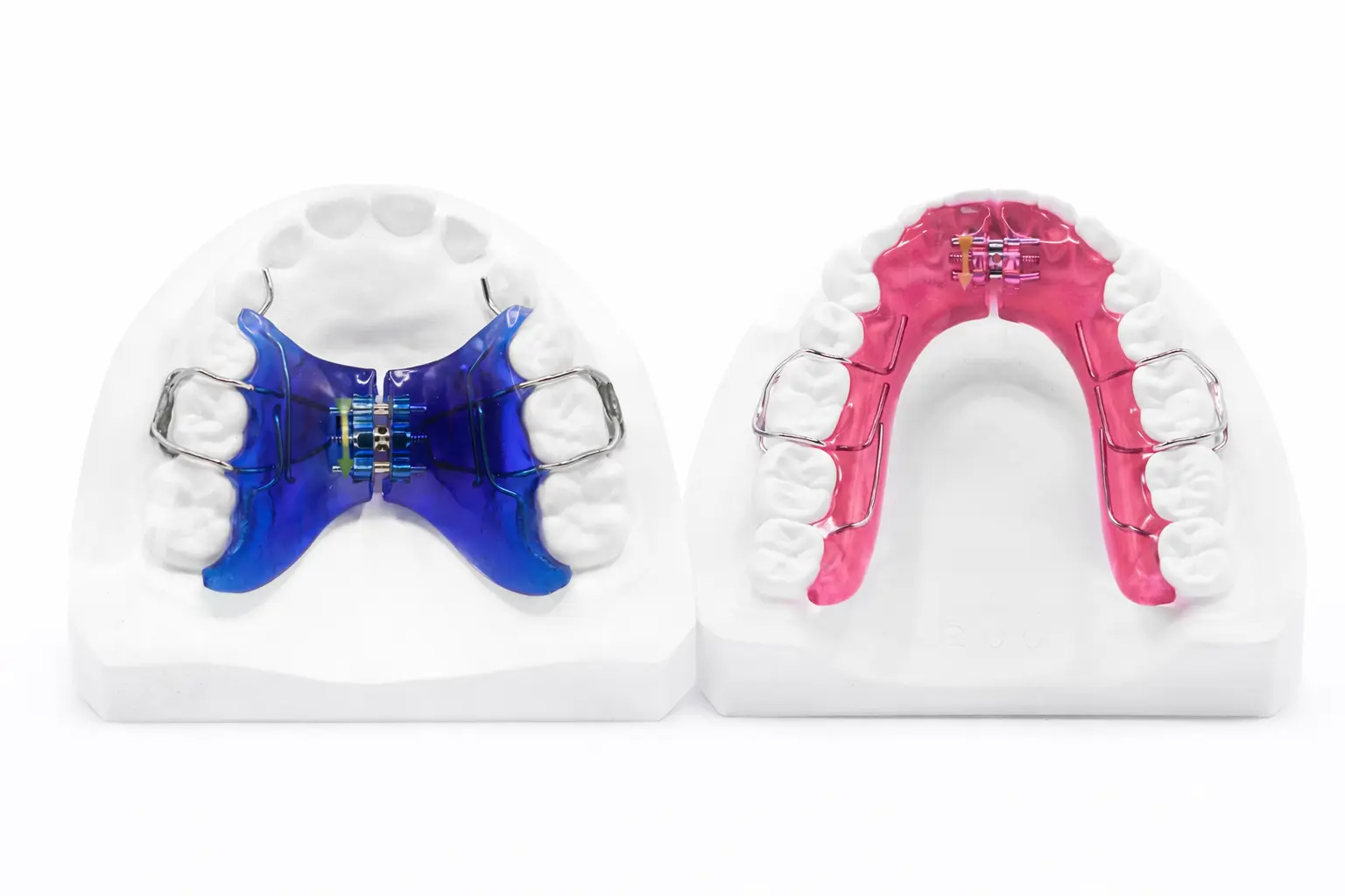 Upper and lower removable expanders