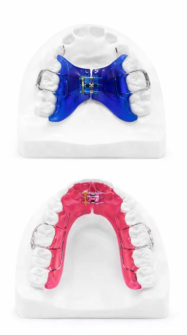 Upper and lower removable expander appliances