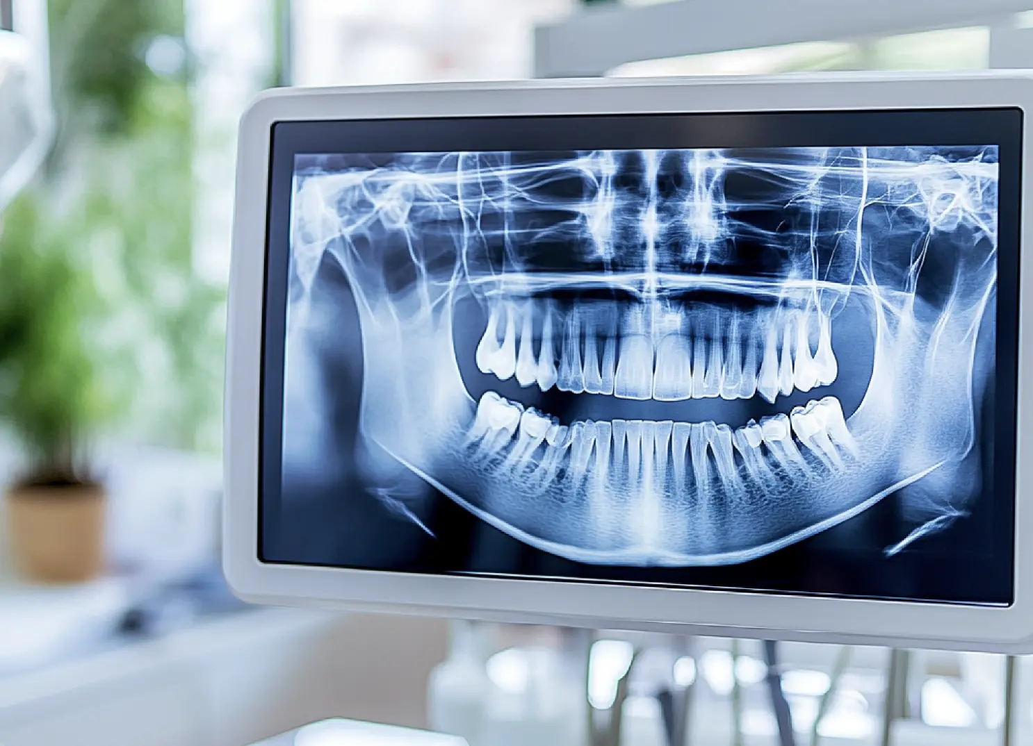 Panoramic x-ray image on monitor